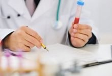 نتيجة الكشف الطبي جامكا برقم الجواز في مصر