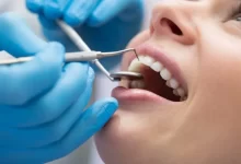 هذا هو افضل دكتور اسنان في الرياض