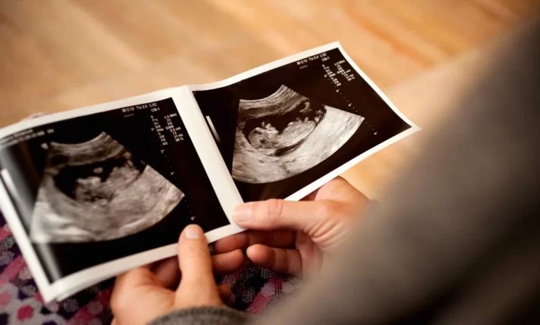 هل يخطئ السونار في تحديد نوع الجنين في الشهر الرابع