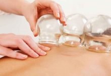 هل تجوز الحجامة في عشر ذي الحجة ؟