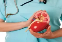 هل يمكن علاج حصوة الكلى خلال أربع ساعات