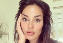 صور: نادين نجيم قبل وبعد عمليات التجميل