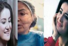 شاهد: صور الفنانة وفاء سالم قبل وبعد عملية التجميل الخاطئة التي خضعت لها