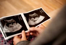 هل يخطئ السونار في تحديد نوع الجنين في الشهر الرابع