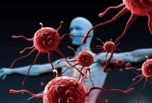 أي من الجمل الآتية صحيح فيما يتعلق بمرض السرطان